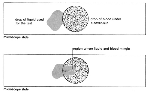 blood and liquid on microscope slide