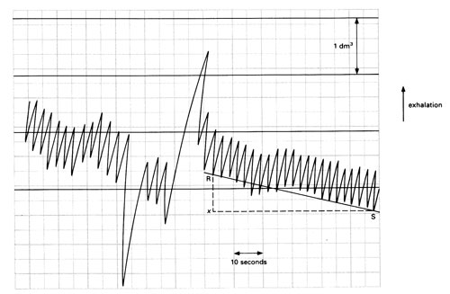 Typical spirometer trace
