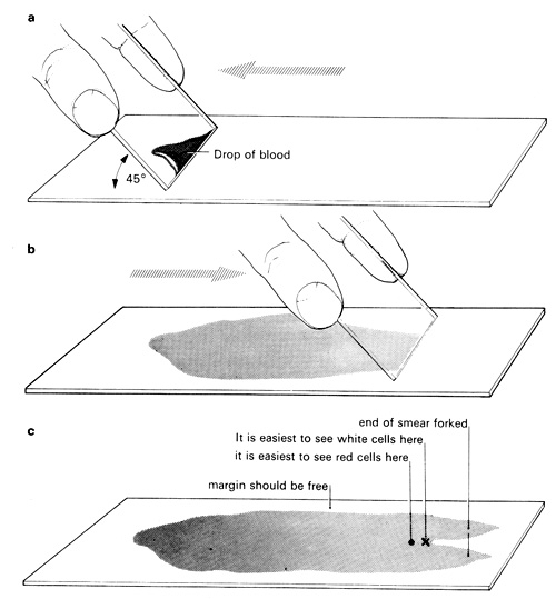 how to set up microscope slide with drop of blood