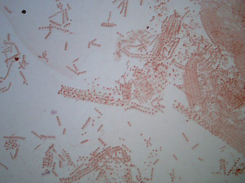 Allium root tip squash meristematic zone