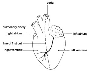 Dissecting a heart: line of first cut